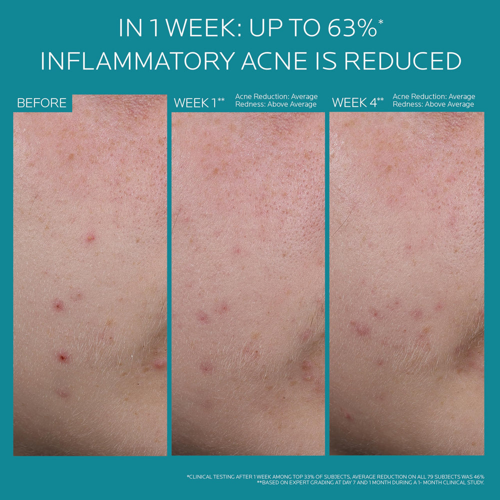 La Roche-Posay Effaclar BPO dermatologist-tested badge on packaging.