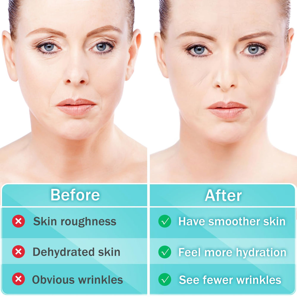 LadPemo crow-feet patch overnight reduces eye wrinkles