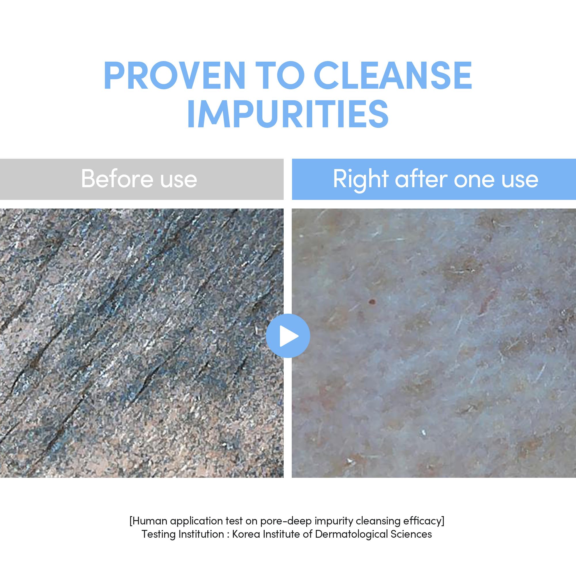 Close-up of the no-foam jelly texture on skin for gentle cleansing