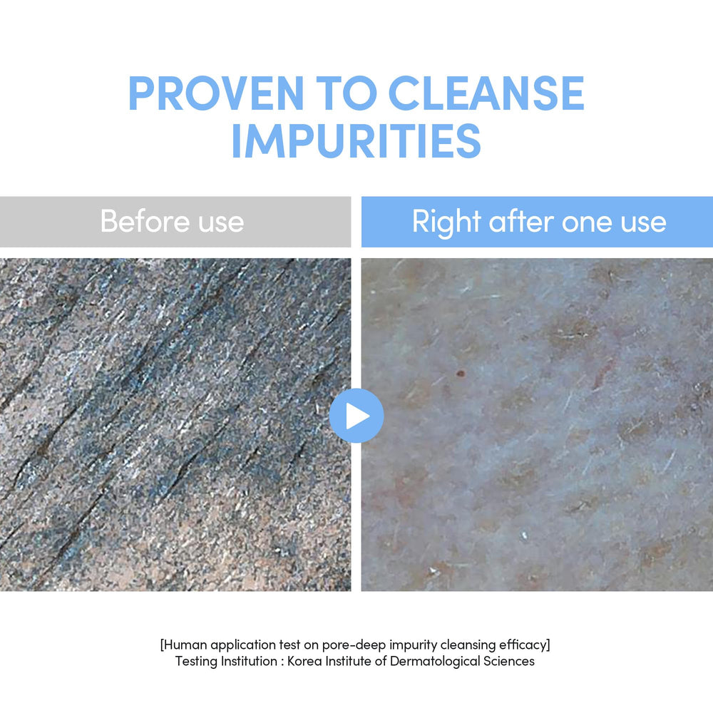 Close-up of the no-foam jelly texture on skin for gentle cleansing