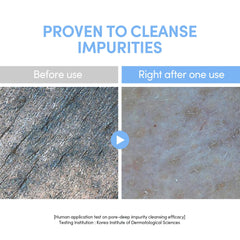 Close-up of the no-foam jelly texture on skin for gentle cleansing