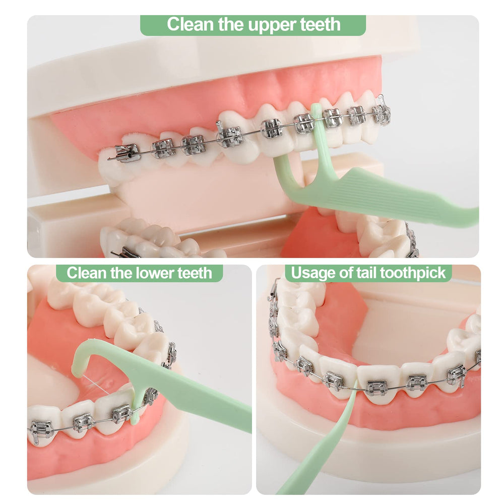 Lakeyface travel-friendly floss pack keeps braces tidy on the go.