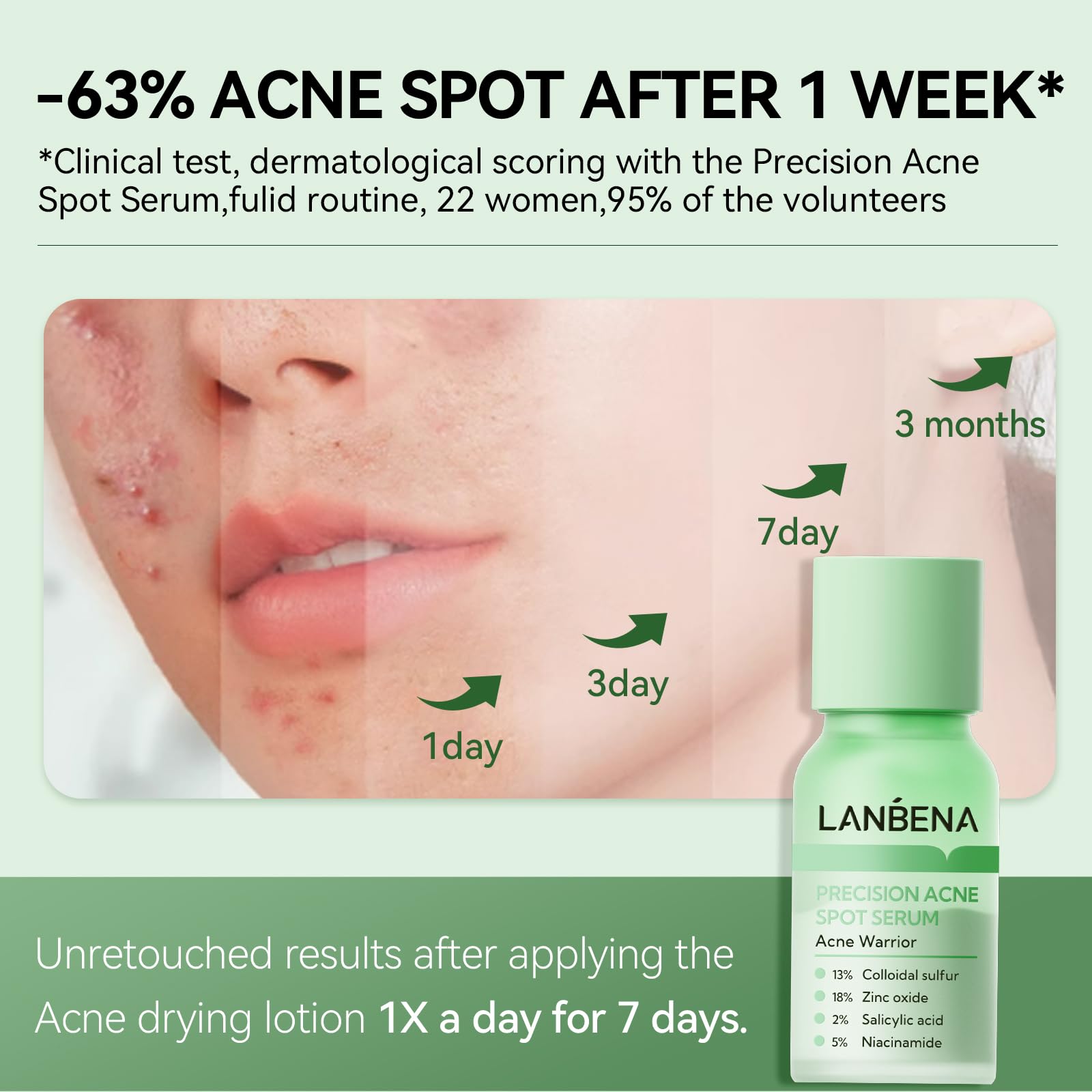 LANBENA sensitive skin formula looks lightweight and non-irritating.