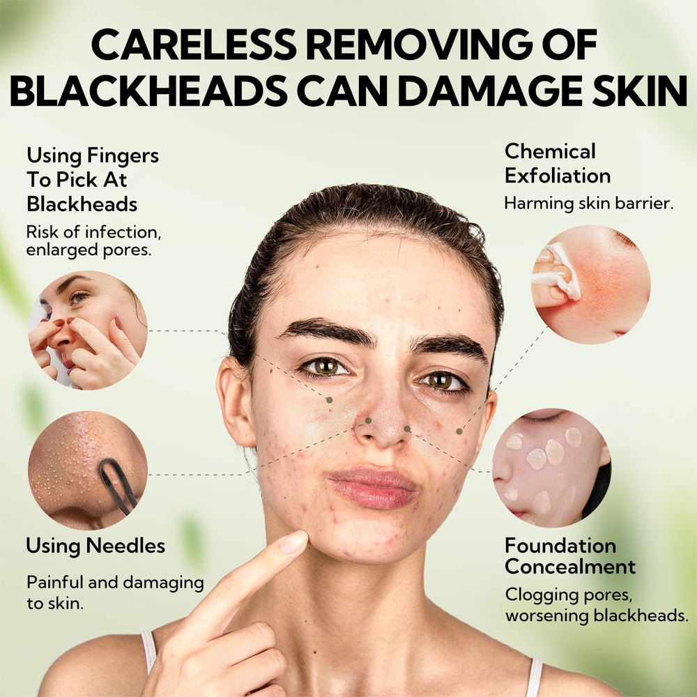 LANBENA natural botanicals with witch hazel and aloe support gentle pore care.