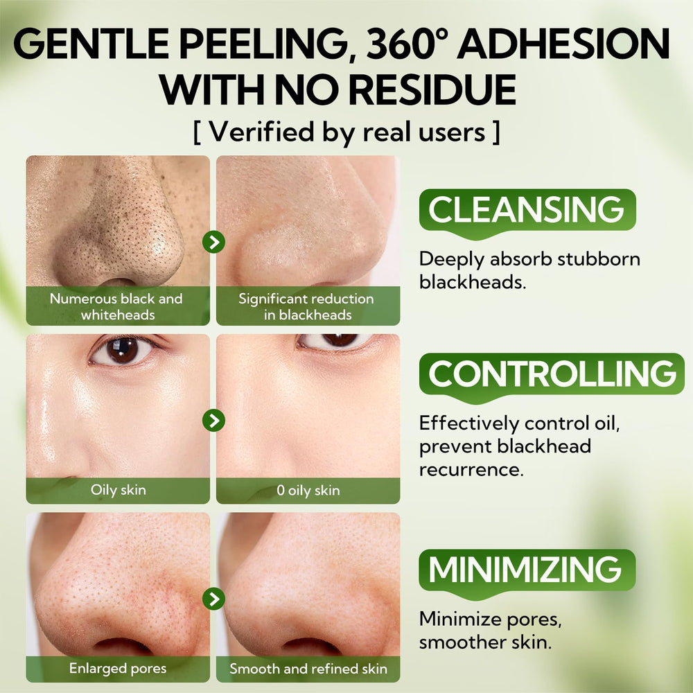 LANBENA bamboo charcoal pore cleansing effect on skin surface.