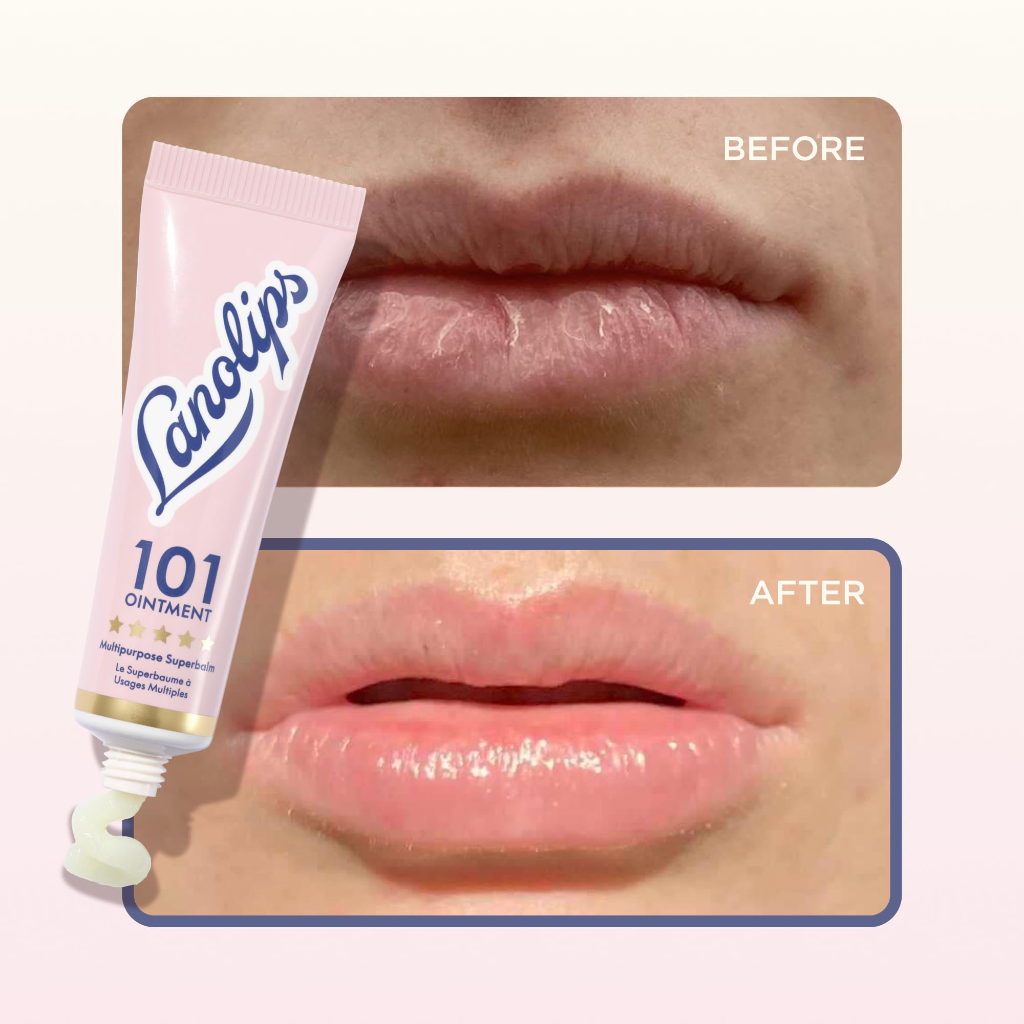 Lanolips 101 Ointment Duo cuticle-care close-up
