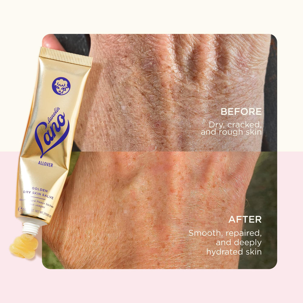 Lanolips Golden Dry Skin Salve hydrates feet with overnight nourishment.