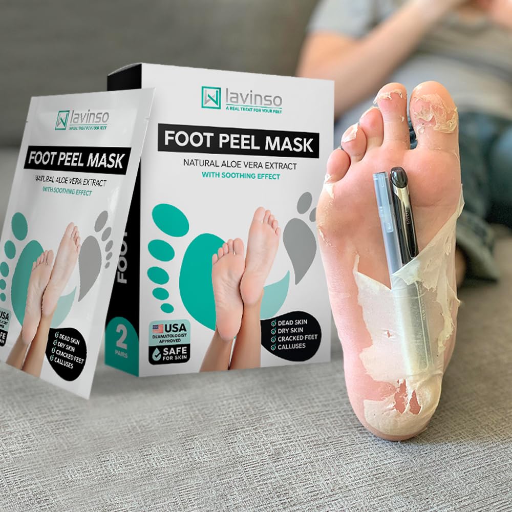 Lavinso foot peel results show soft feet after peeling
