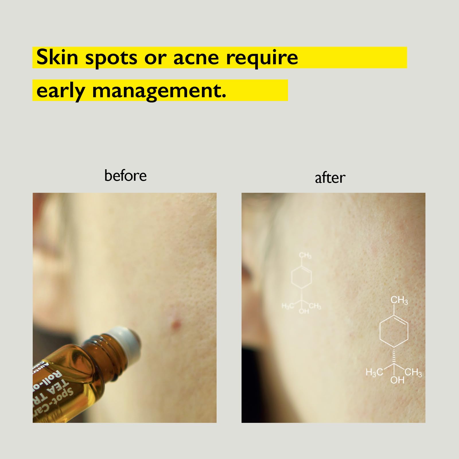 Gentle formula for sensitive skin with Lazy Society tea tree oil roll-on