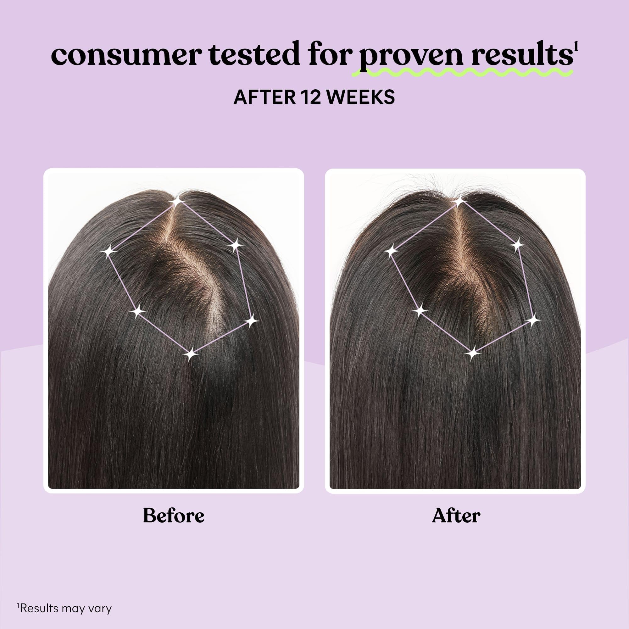 Clinical study graphic illustrating reduced shedding and thicker-looking hair