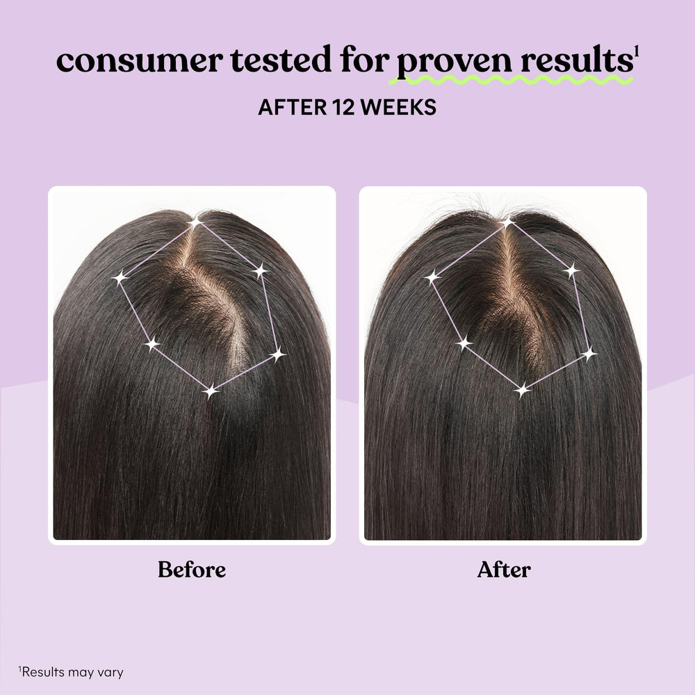 Clinical study graphic illustrating reduced shedding and thicker-looking hair
