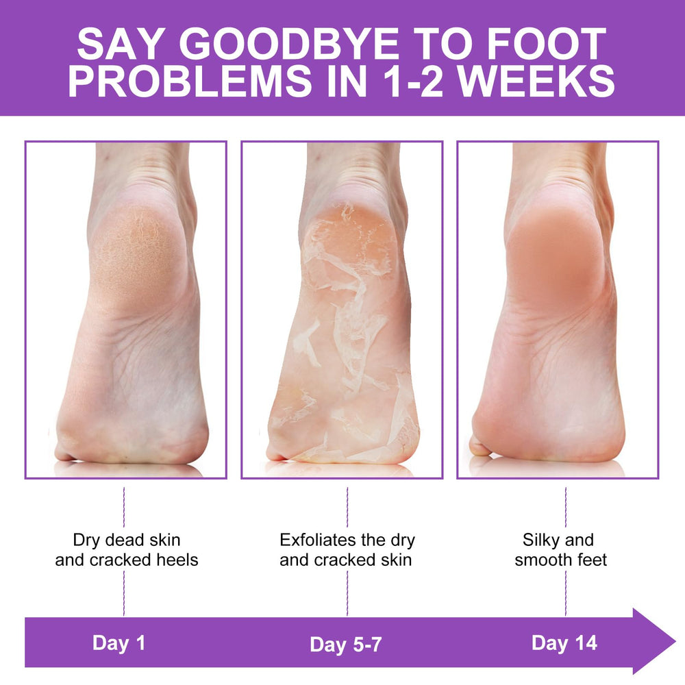 Liefiet lavender foot mask focuses on heel care and callus relief.