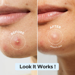 LitBear patches gentle on sensitive skin with no additives