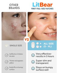 LitBear XL patch applied on skin for targeted blemish care.