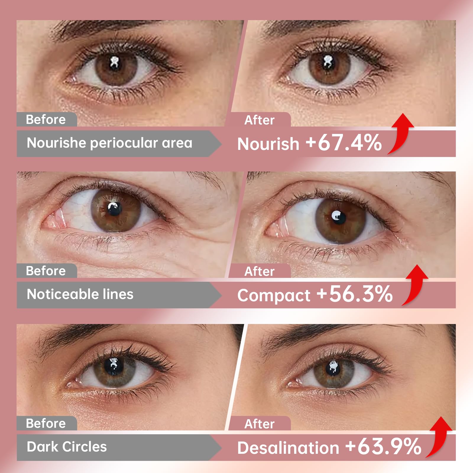 LLVYUO Novoy hydrolyzed collagen supports absorption in delicate eye skin.