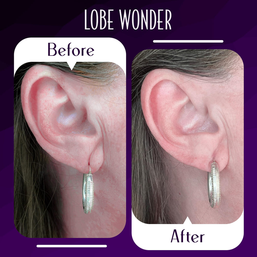 Lobe Wonder hypoallergenic latex-free patches close-up for safe skin contact