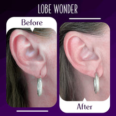 Lobe Wonder hypoallergenic latex-free patches close-up for safe skin contact