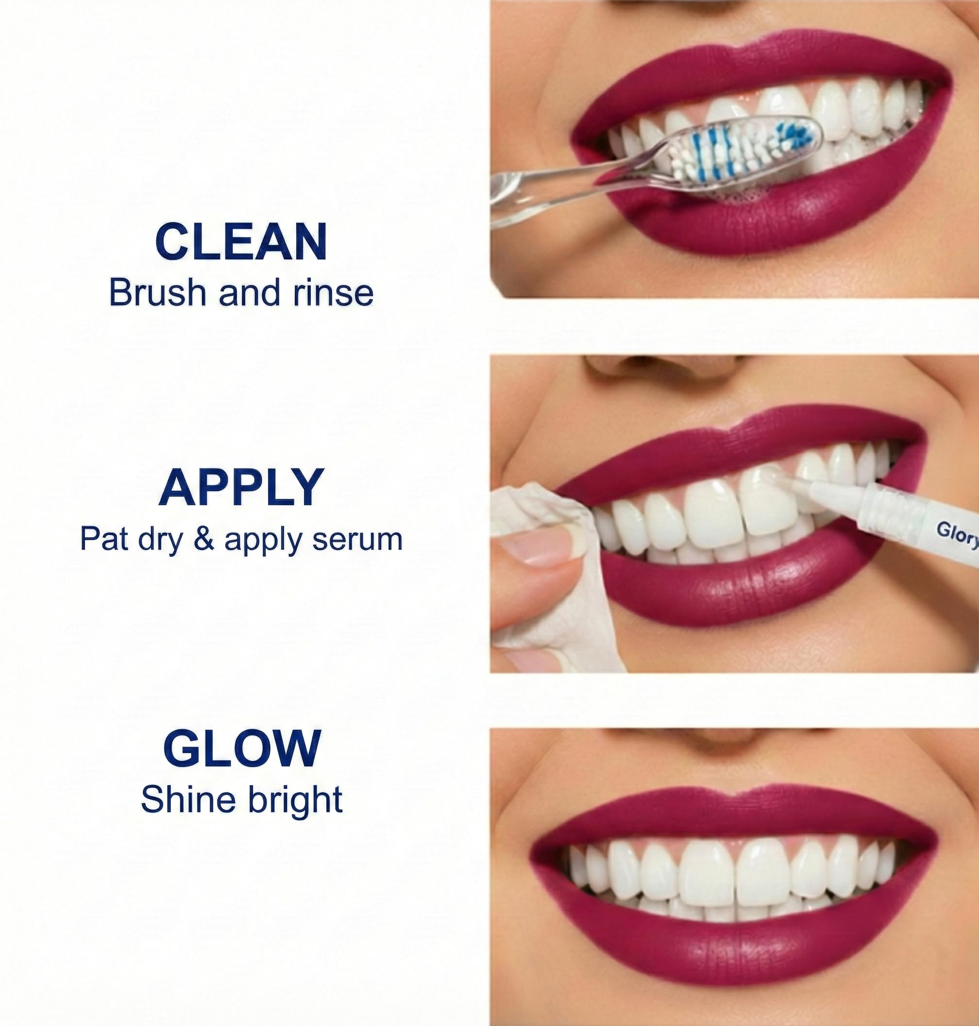 LoQFA 35% carbamide peroxide gel drop for powerful yet gentle whitening.
