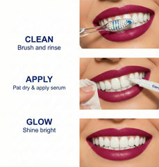 LoQFA 35% carbamide peroxide gel drop for powerful yet gentle whitening.