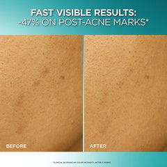 L'Oreal Paris Bright Reveal exfoliant on hand shows gentle glow after use