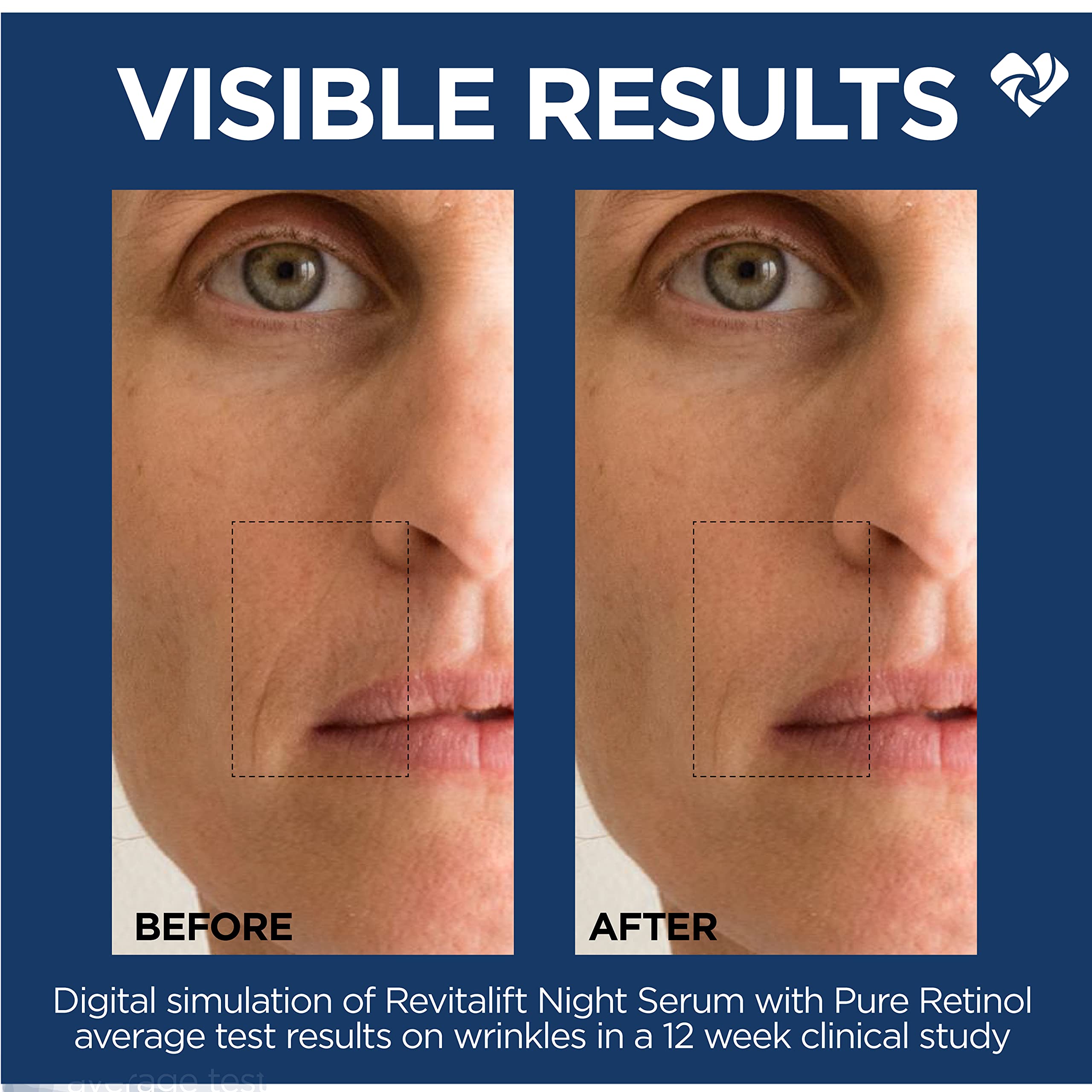 Fragrance-free label on Revitalift formula signals fragrance-free care