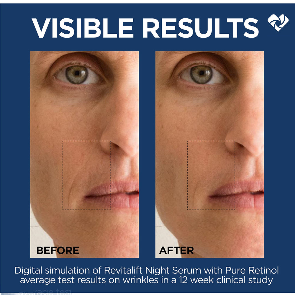 Fragrance-free label on Revitalift formula signals fragrance-free care