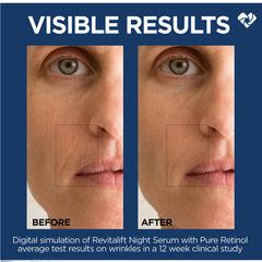 Fragrance-free label on Revitalift formula signals fragrance-free care