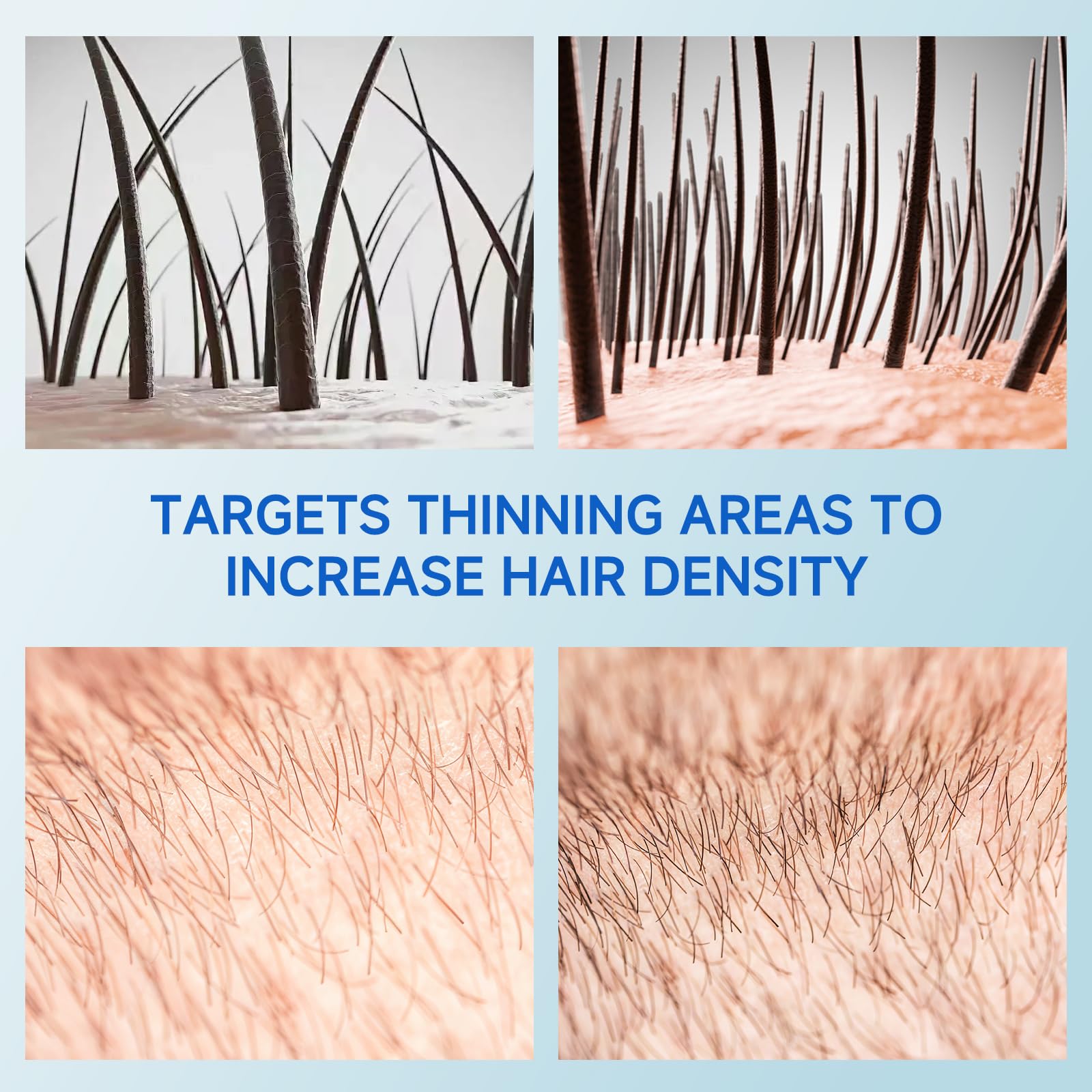 Loreviya Rollerball design delivers precise scalp application with minimal waste.