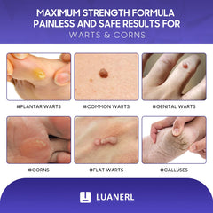 Luanerl 20% Salicylic Solution targets keratin buildup on warts for quicker care.