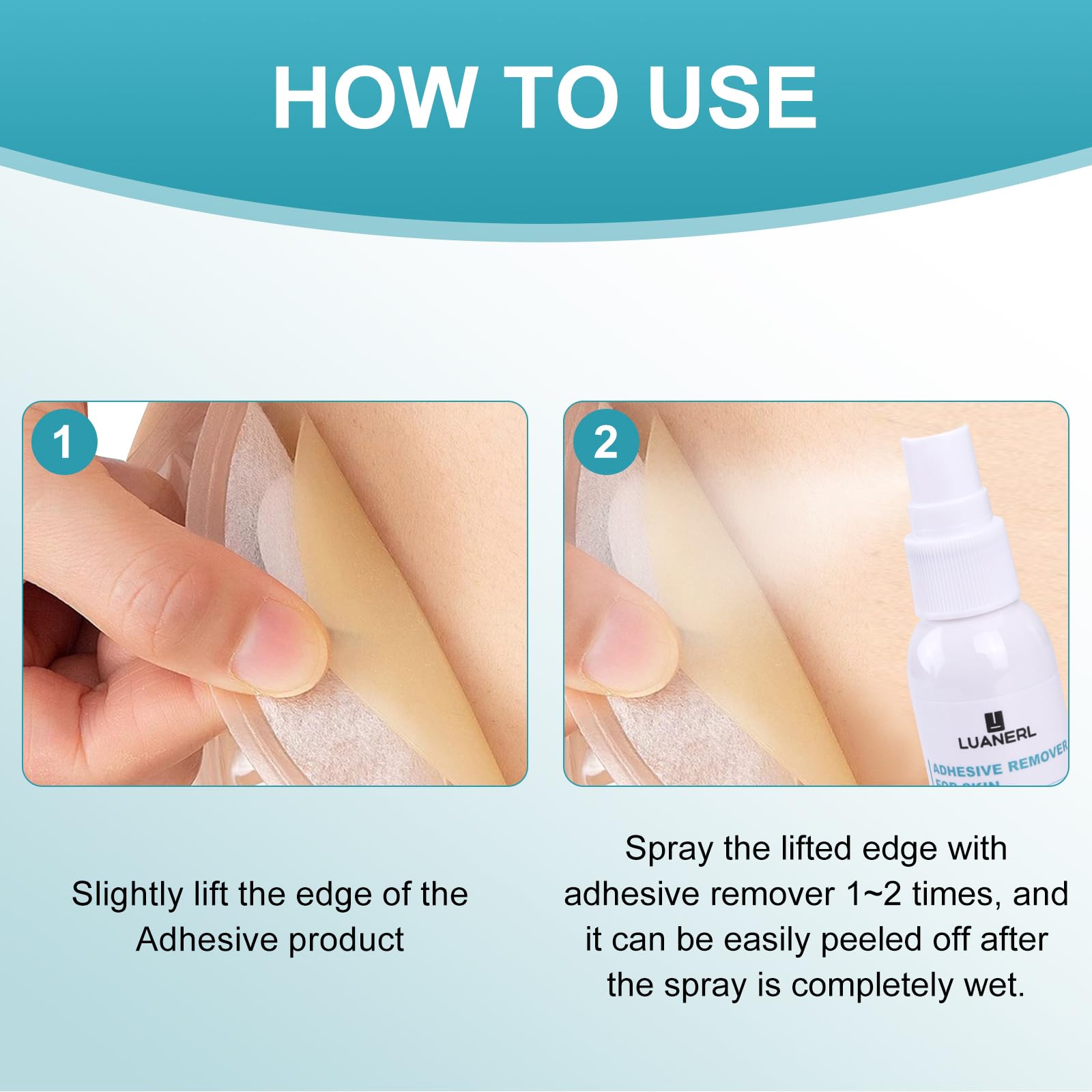 Luanerl adhesive remover used on ostomy and bandage materials