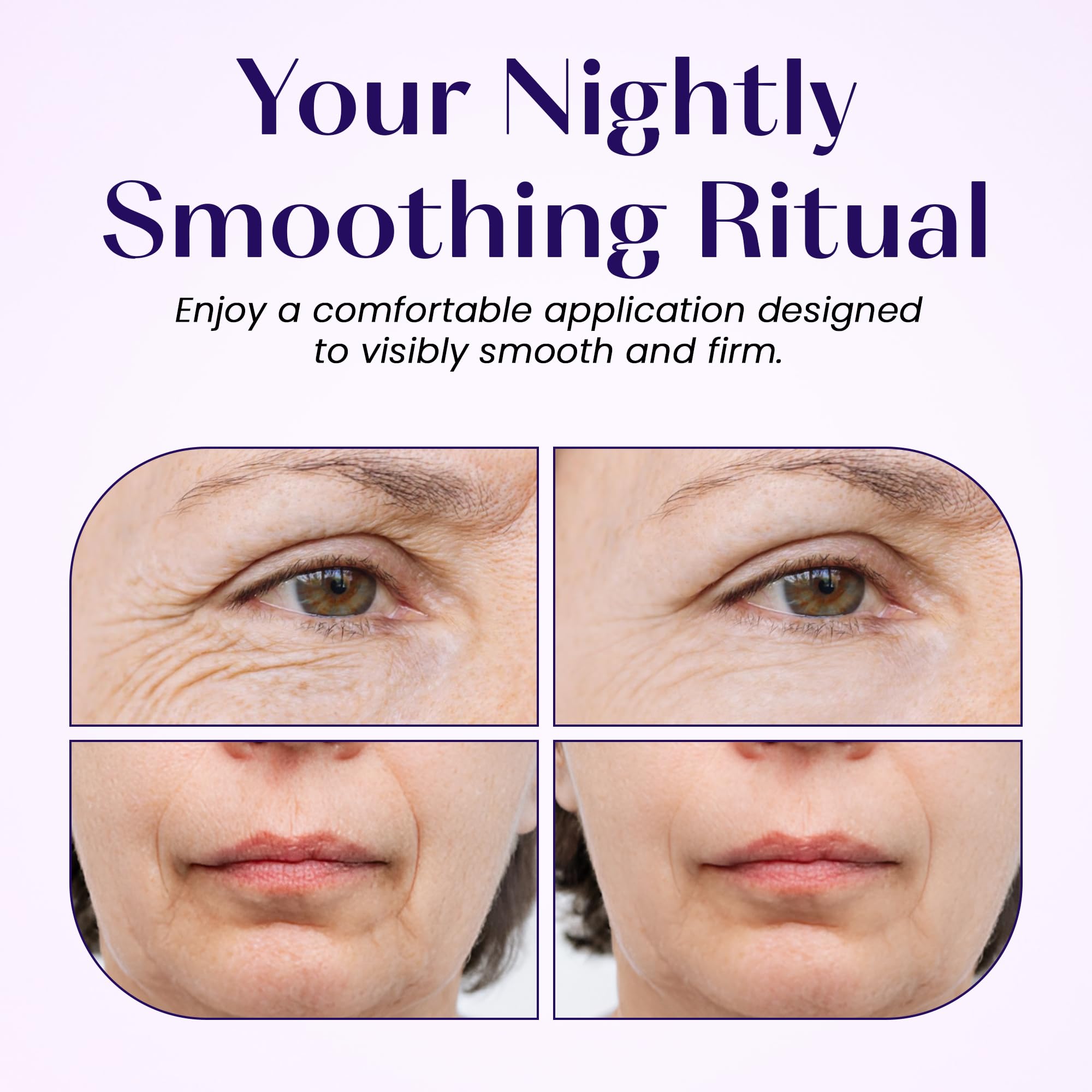 LumiDew patch helps smooth marionette lines around the mouth