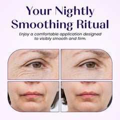 LumiDew patch helps smooth marionette lines around the mouth
