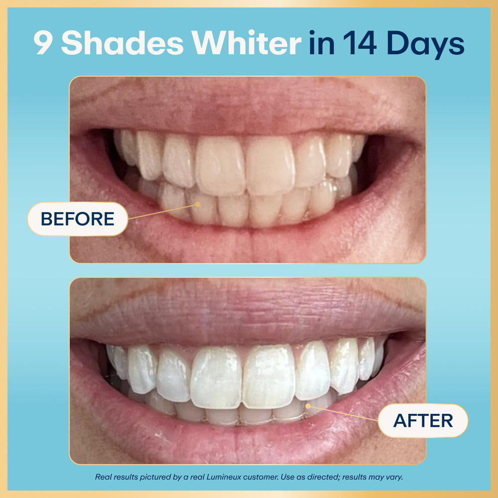 Open Lumineux pack showing strips for gentle at-home whitening routine