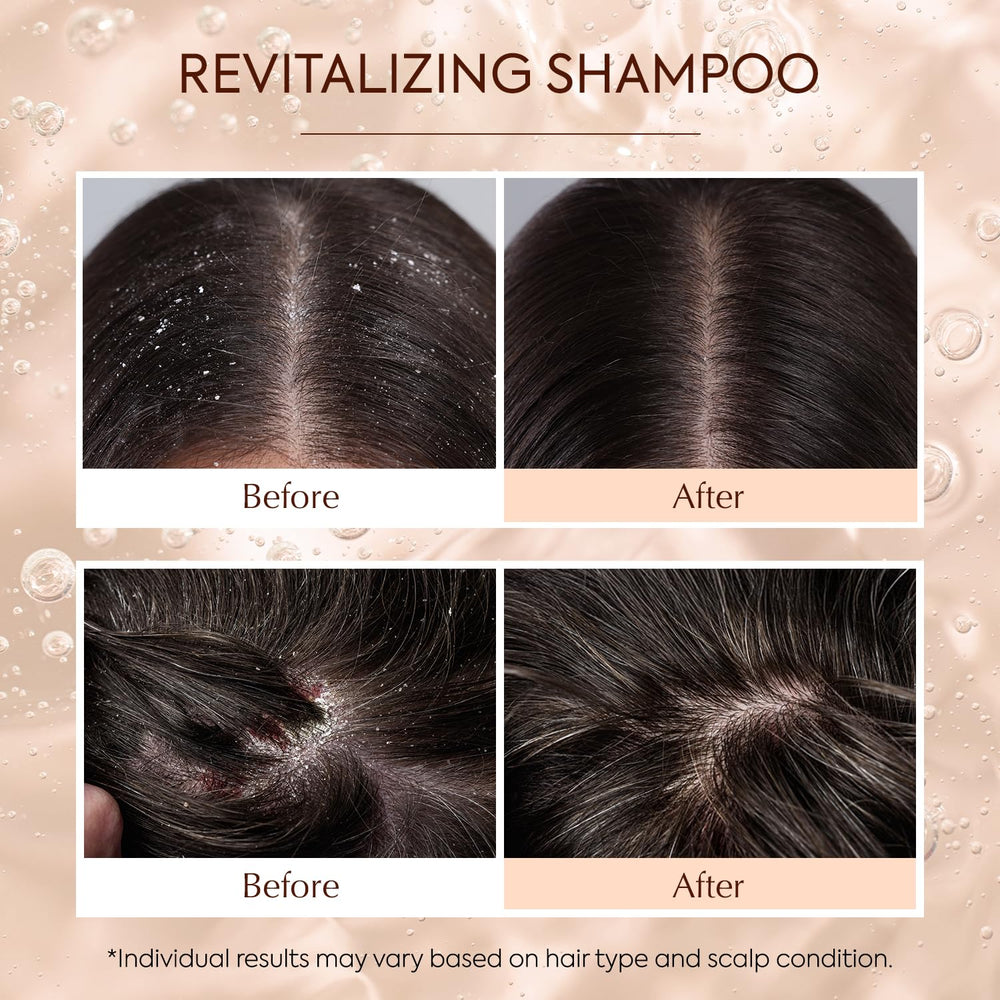 Luxvez daily self-care routine image featuring shampoo for calm scalp