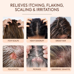Luxvez women’s scalp lather application demonstrates gentle cleansing for sensitive skin