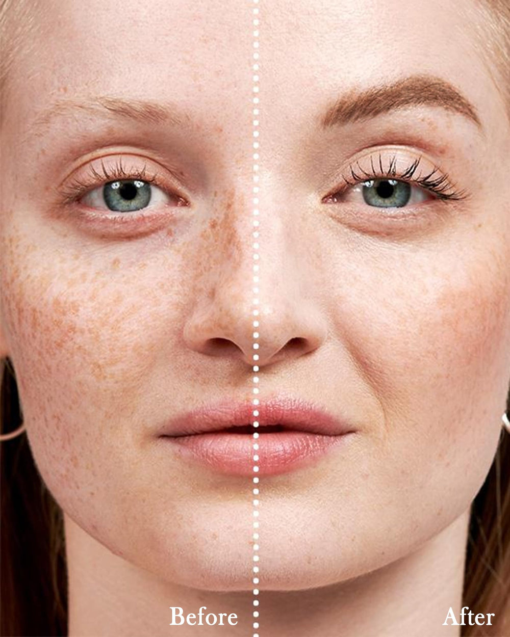 LYSdefeu 20-minute peel-off process for quick results