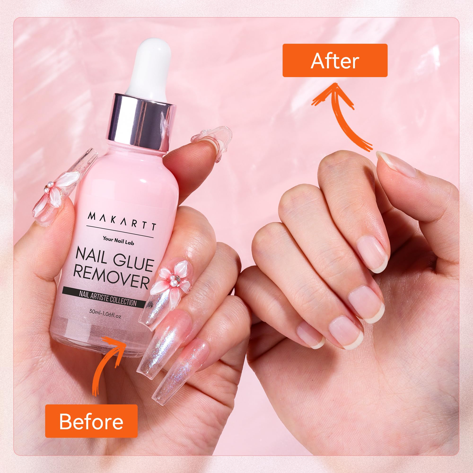 Makartt all-in-one kit for easy at-home removal.