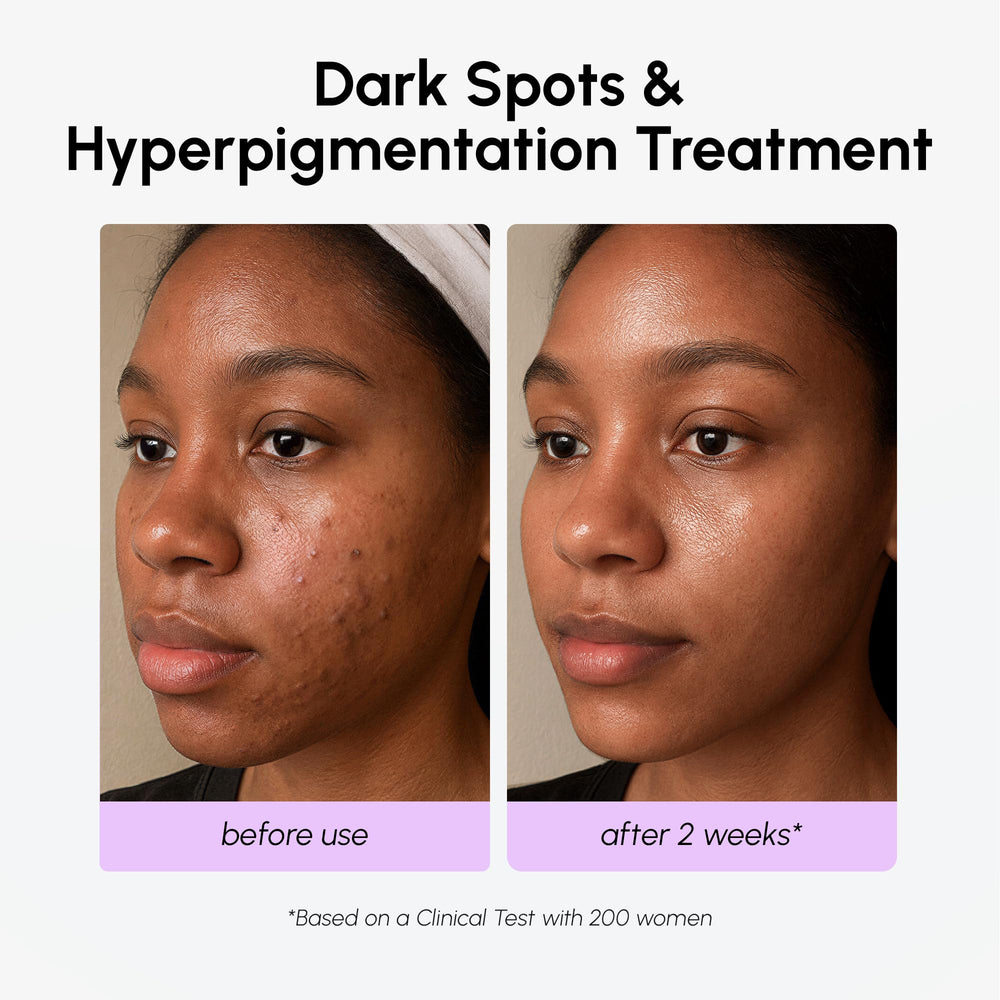 MAREE dark-spot-remover-body frame hints at versatile use on larger areas