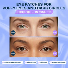 MAREE cooling eye patches soothe puffiness for a refreshed look.