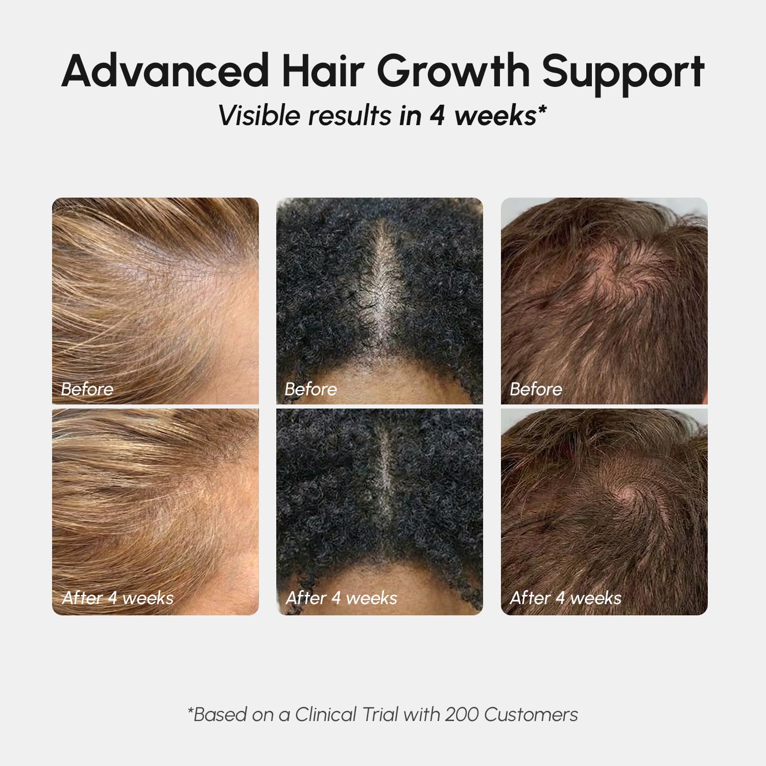 MAREE Hair Growth Spray root application targets the scalp for better reach.