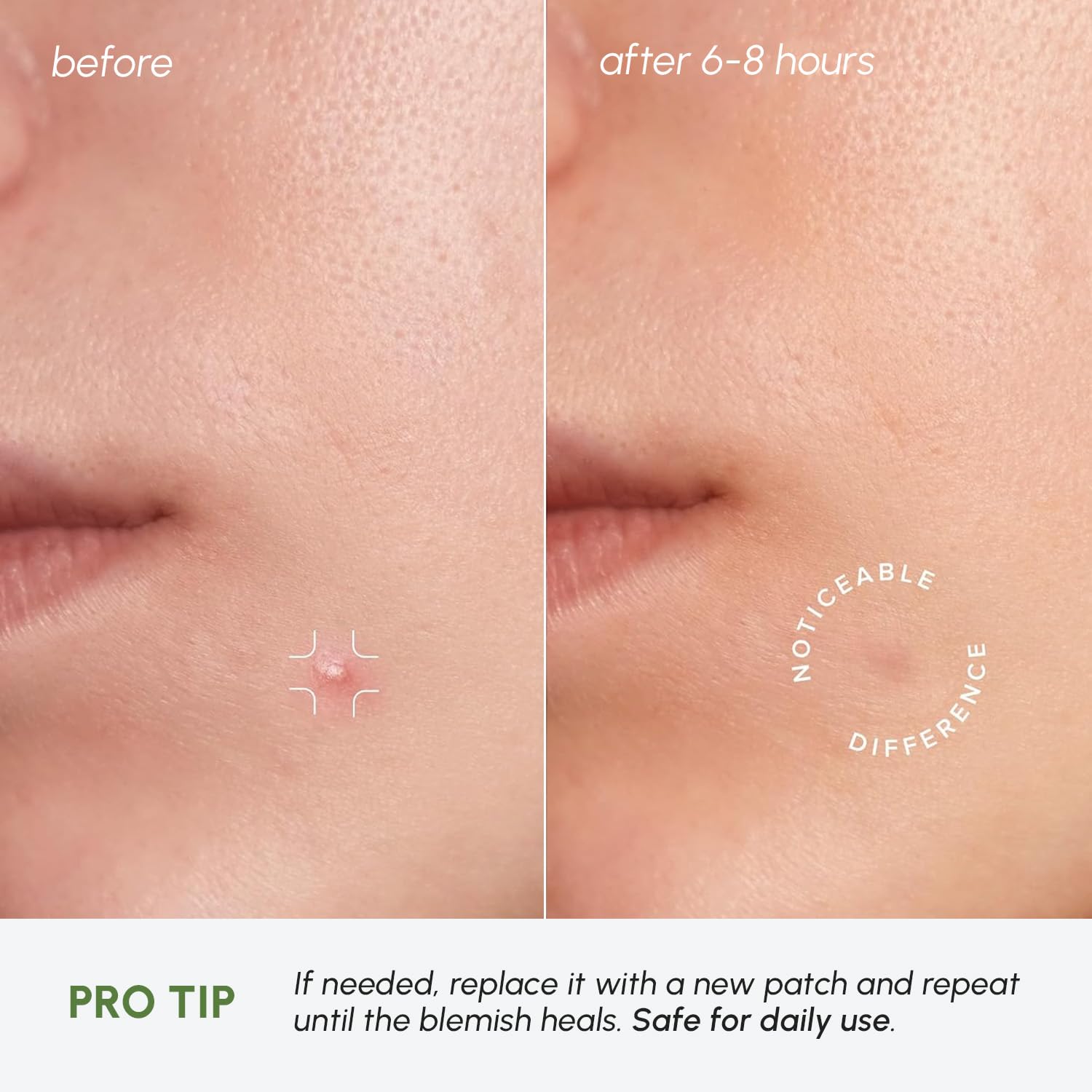 MAREE Under Makeup-Friendly Patches can be worn with makeup.