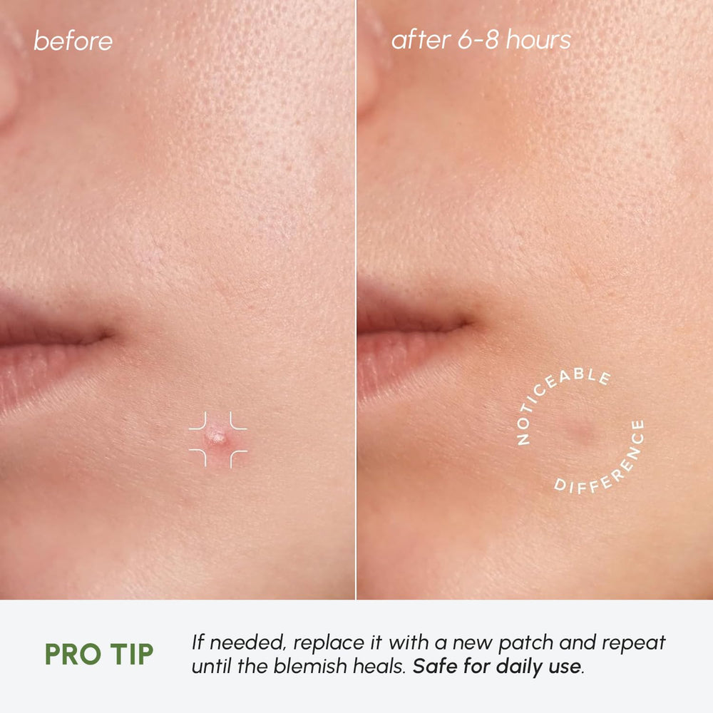 MAREE Under Makeup-Friendly Patches can be worn with makeup.