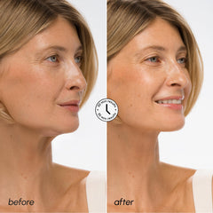 MAREE V Line lifting mask features retinol for smoother skin texture.