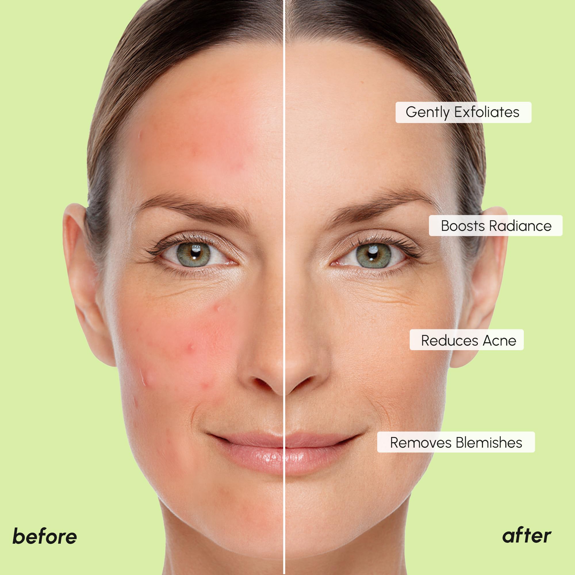 MAREE Witch Hazel balances and soothes skin during toning.