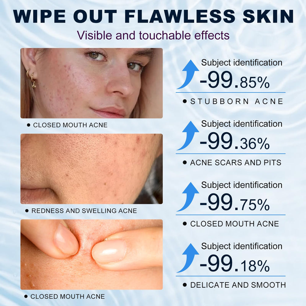 Marianp Azelaic Acid 10% Cream ingredients panel shows non-irritating care