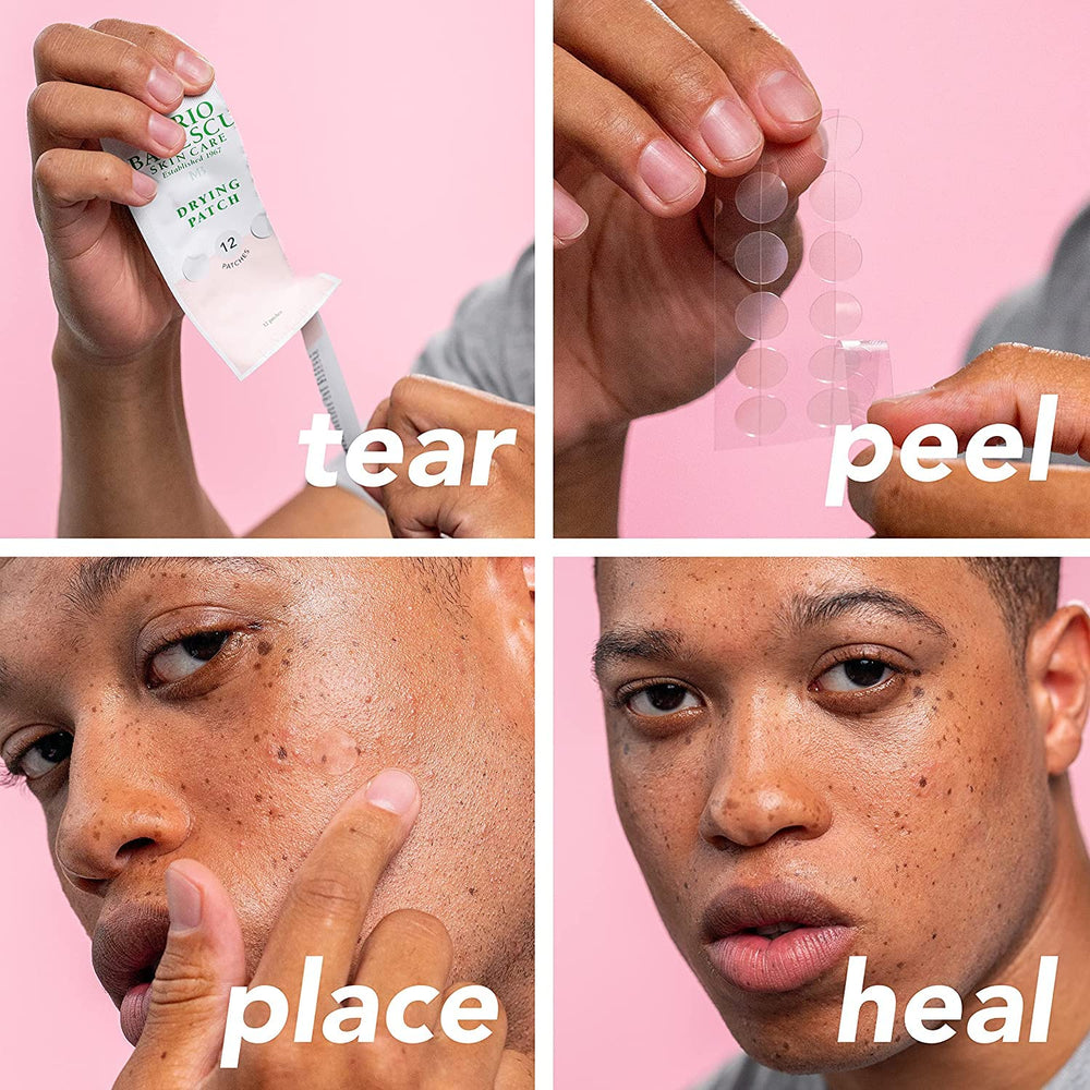 Mario Badescu drying patch on skin demonstrates oil-absorbing action.