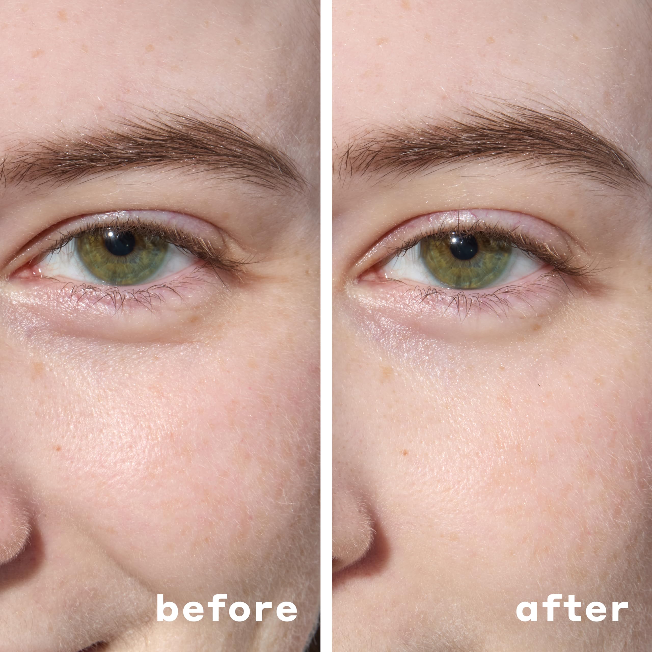 Mario Badescu Hydrogel Under Eye Patches closeup highlighting hyaluronic acid benefits