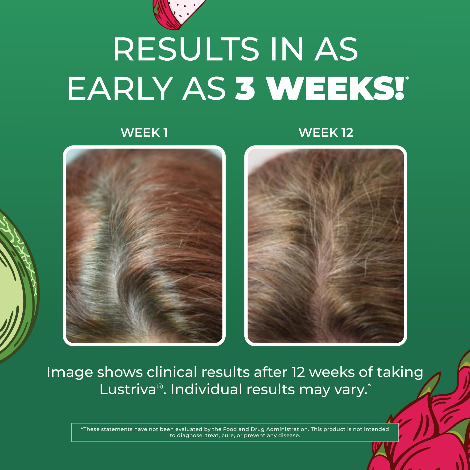 Lustriva hair growth bottle indicating potential fuller hair with consistent use