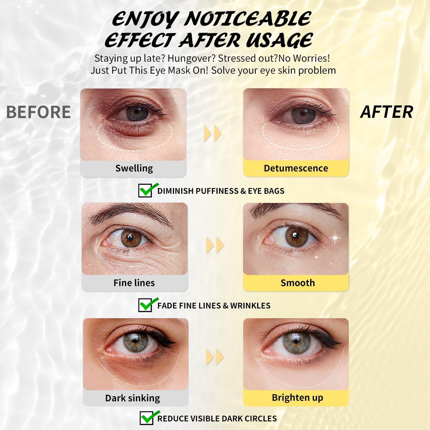 Maskiss hyaluronic acid eye patches hydrate and smooth delicate under-eye skin.