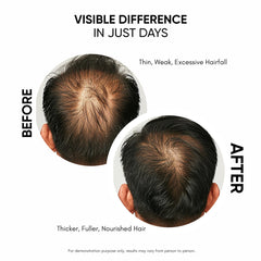 A hand massages Masofta serum into the scalp for nourishment.